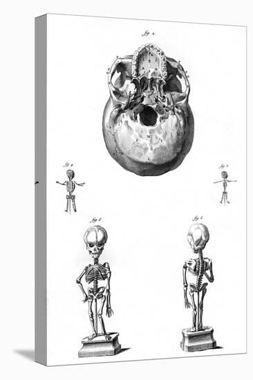 Skull and Foetus Skeletons-null-Stretched Canvas