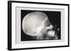 Skull and Hand-null-Framed Art Print