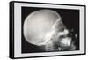 Skull and Hand-null-Framed Stretched Canvas