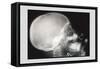 Skull and Hand-null-Framed Stretched Canvas