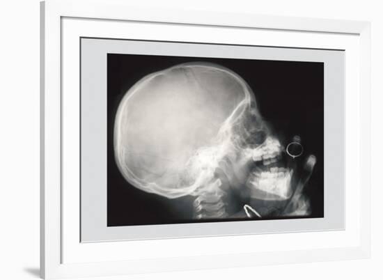 Skull and Hand-null-Framed Art Print