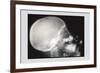 Skull and Hand-null-Framed Art Print