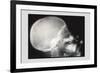 Skull and Hand-null-Framed Art Print