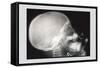 Skull and Hand-null-Framed Stretched Canvas