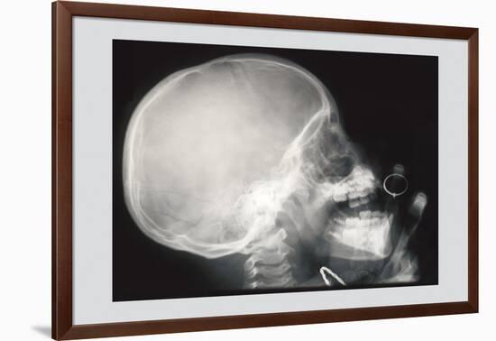 Skull and Hand-null-Framed Art Print