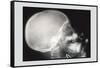 Skull and Hand-null-Framed Stretched Canvas