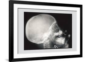 Skull and Hand-null-Framed Premium Giclee Print