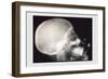 Skull and Hand-null-Framed Art Print