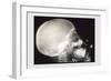 Skull and Hand-null-Framed Art Print