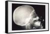 Skull and Hand-null-Framed Stretched Canvas