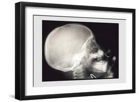 Skull and Hand-null-Framed Premium Giclee Print