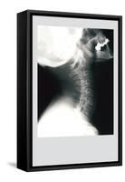 Skull and Neck-null-Framed Stretched Canvas