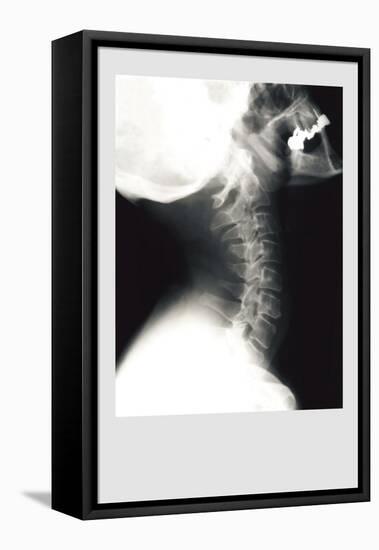 Skull and Neck-null-Framed Stretched Canvas