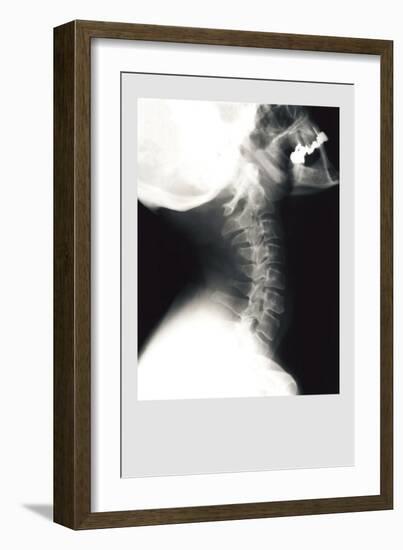 Skull and Neck-null-Framed Art Print