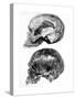 Skull of Piltdown Man (Eanothropus Daswon), 1912-null-Stretched Canvas