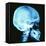 Skull X-ray-PASIEKA-Framed Stretched Canvas