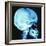 Skull X-ray-PASIEKA-Framed Premium Photographic Print