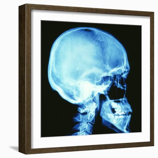 Skull X-ray-PASIEKA-Framed Premium Photographic Print