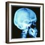 Skull X-ray-PASIEKA-Framed Premium Photographic Print