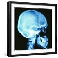 Skull X-ray-PASIEKA-Framed Premium Photographic Print