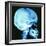 Skull X-ray-PASIEKA-Framed Premium Photographic Print