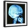 Skull X-ray-PASIEKA-Framed Premium Photographic Print