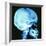 Skull X-ray-PASIEKA-Framed Premium Photographic Print