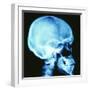 Skull X-ray-PASIEKA-Framed Premium Photographic Print