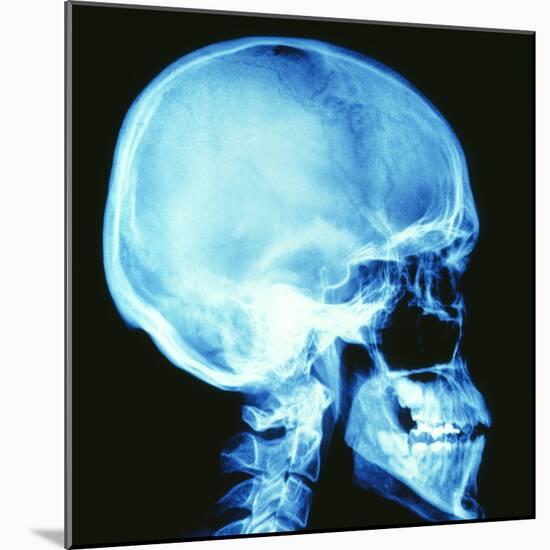 Skull X-ray-PASIEKA-Mounted Premium Photographic Print