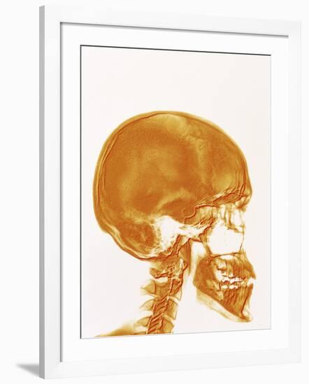 Skull X-ray-PASIEKA-Framed Photographic Print