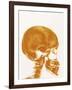 Skull X-ray-PASIEKA-Framed Photographic Print