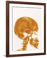 Skull X-ray-PASIEKA-Framed Photographic Print