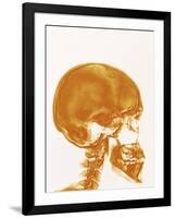 Skull X-ray-PASIEKA-Framed Photographic Print