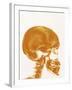 Skull X-ray-PASIEKA-Framed Photographic Print