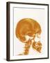 Skull X-ray-PASIEKA-Framed Photographic Print