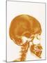 Skull X-ray-PASIEKA-Mounted Photographic Print