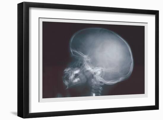 Skull-null-Framed Art Print