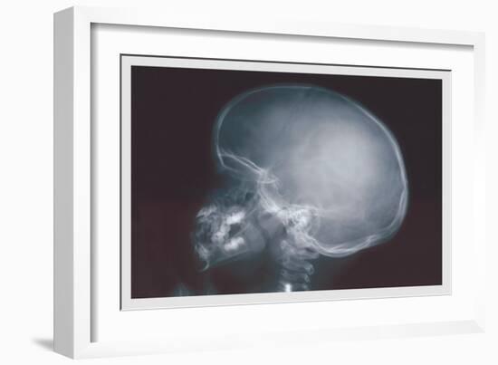 Skull-null-Framed Art Print