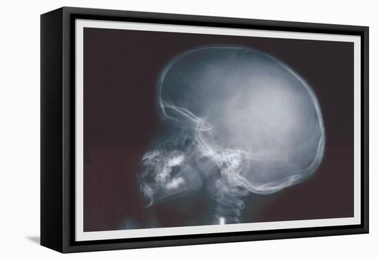 Skull-null-Framed Stretched Canvas