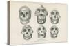 Skulls from Photographs-null-Stretched Canvas