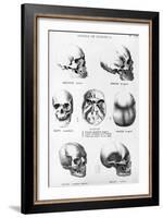 Skulls of Murderers, from L'Homme Criminel by Cesare Lombroso-null-Framed Giclee Print