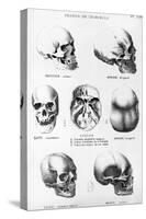 Skulls of Murderers, from L'Homme Criminel by Cesare Lombroso-null-Stretched Canvas