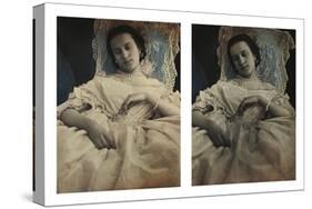 Sleeping Woman in White Dress, c.1851-55. Stereoscopic Daguerreotype-Alex Gouin-Stretched Canvas