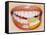 Slice of Lemon Between Teeth-Cristina-Framed Stretched Canvas