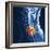 Slipped Disc, MRI Scan-PASIEKA-Framed Premium Photographic Print