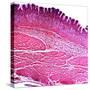 Small Intestine Section, Light Micrograph-Dr. Keith Wheeler-Stretched Canvas