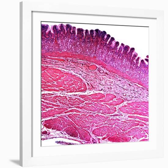 Small Intestine Section, Light Micrograph-Dr. Keith Wheeler-Framed Photographic Print