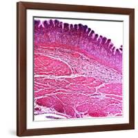 Small Intestine Section, Light Micrograph-Dr. Keith Wheeler-Framed Photographic Print