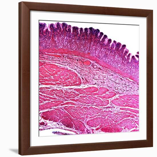 Small Intestine Section, Light Micrograph-Dr. Keith Wheeler-Framed Photographic Print