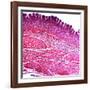 Small Intestine Section, Light Micrograph-Dr. Keith Wheeler-Framed Photographic Print